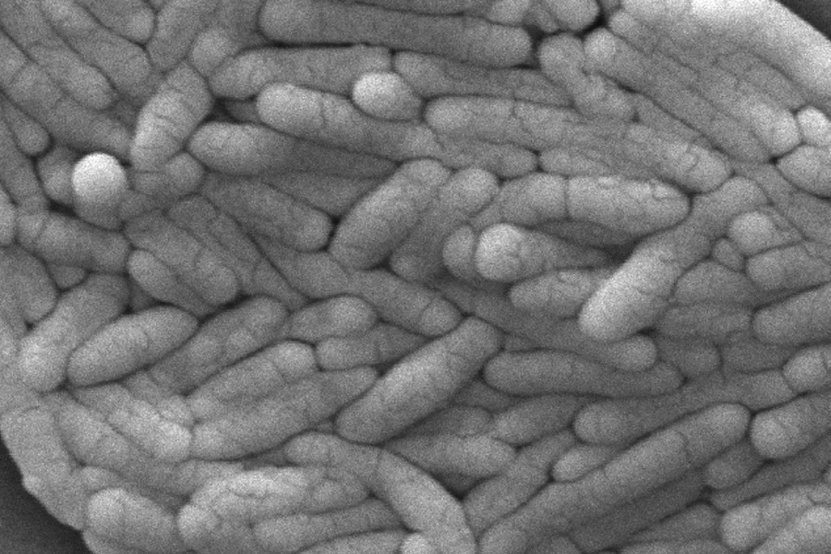 Person dies and hundreds fall ill in UK salmonella outbreak linked to eggs
