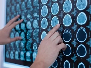 Pratiquer ce sport à haut niveau est dangereux pour le cerveau, mais c’est probablement pire que ce que nous pensions