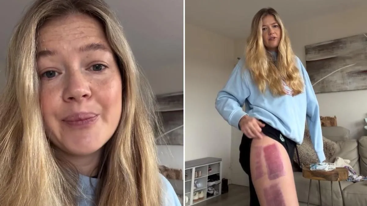 Leah Stawart: Coogee shark attack survivor shares sad recovery update that has left her ‘devastated’