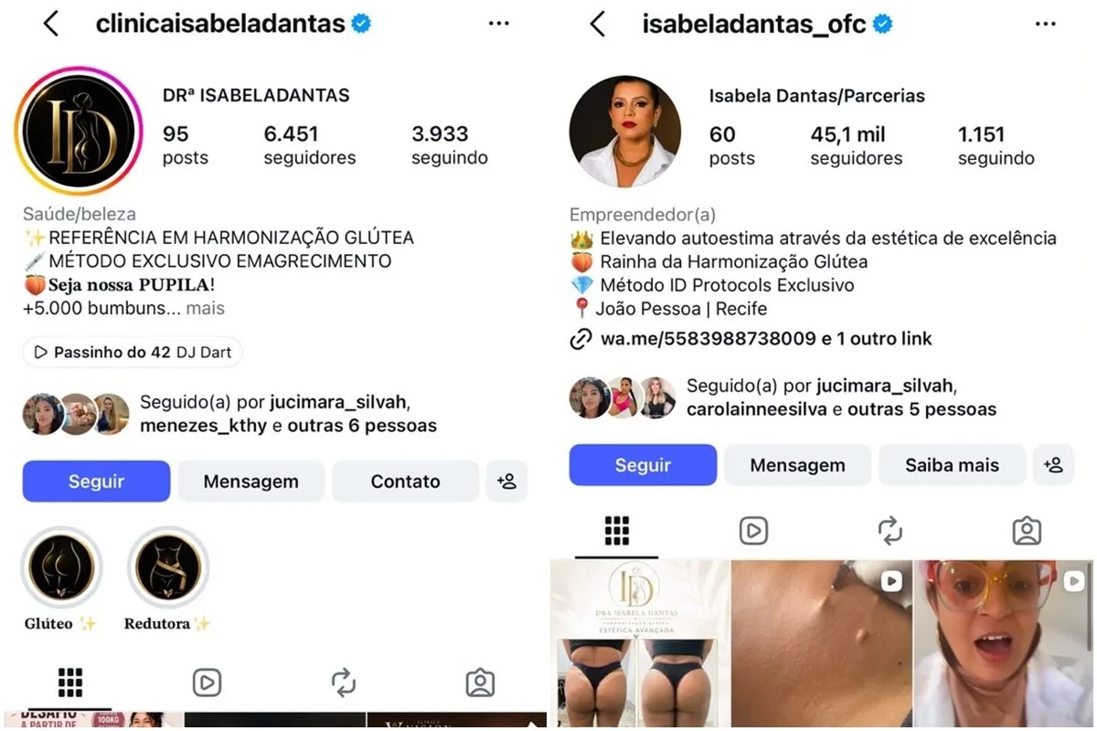 Mulher é presa suspeita de se passar por médica e aplicar silicone de construção em harmonização de glúteos, na PB