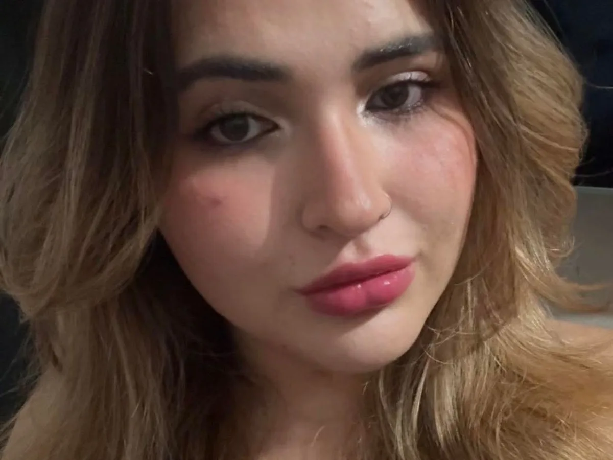 Mulher de 23 anos morre após ser atingida por galho de árvore no Parque dos Poderes em Campo Grande