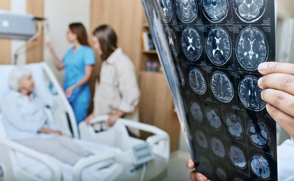 Uma célula do cérebro pode ajudar a evitar danos do Alzheimer