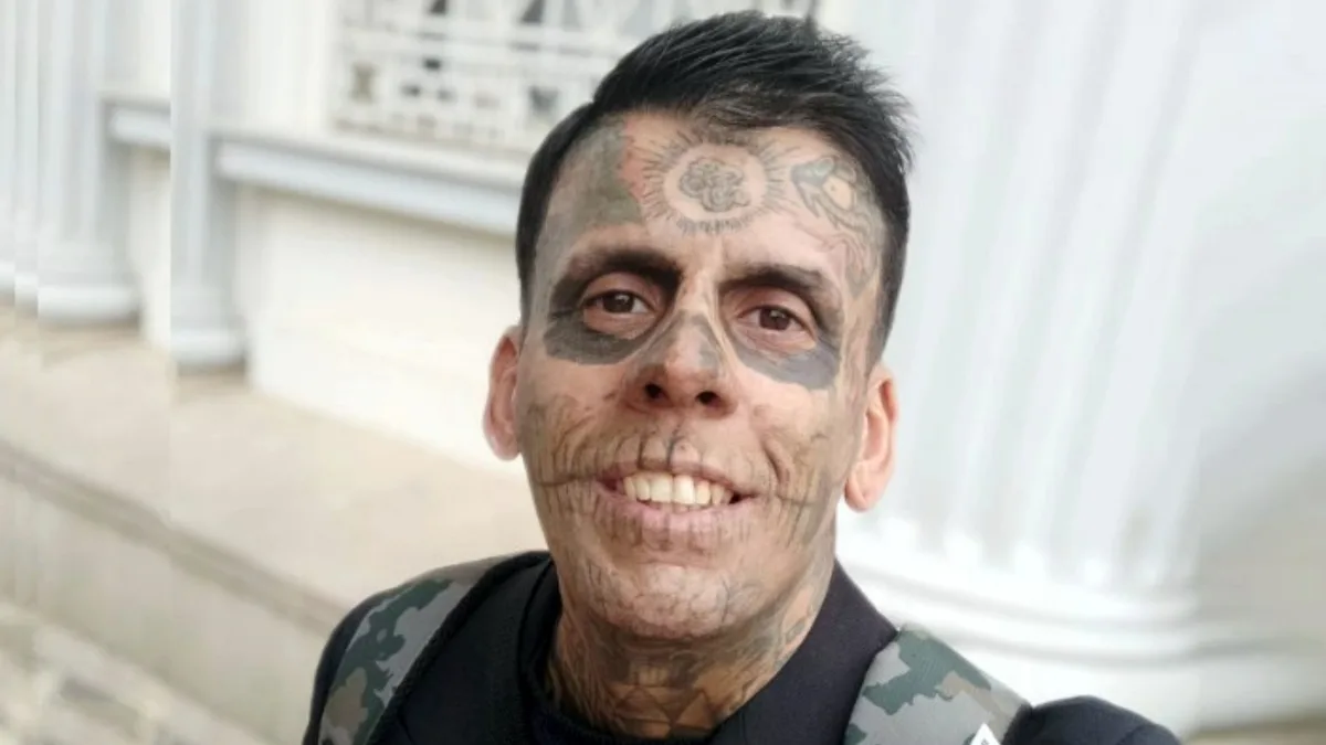 Homem “mais tatuado do Brasil” toma susto com diagnóstico recebido em sessão para remover tatuagem e pede ajuda: ‘Fui pego de surpresa’ Homem “mais tatuado do Brasil” toma susto com diagnóstico recebido em sessão para remover tatuagem e pede ajuda: ‘Fui pego de surpresa’