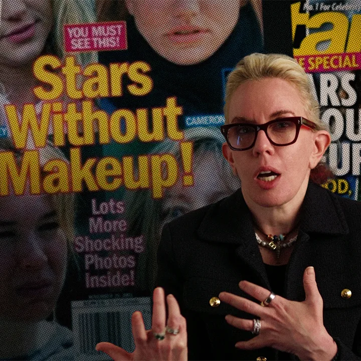 ‘I’m Not Ashamed of My Face-Lift’