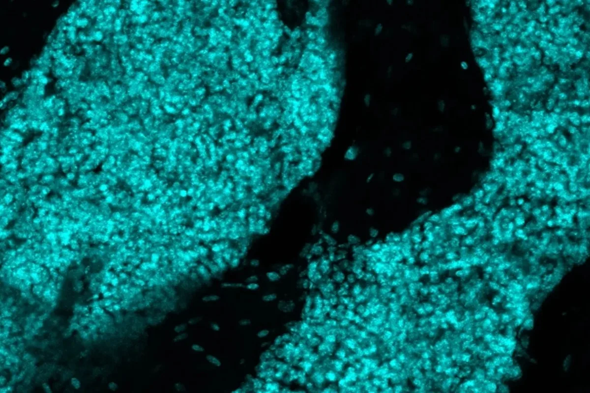 Cientistas descobrem órgão no crânio que pode atuar contra tumores