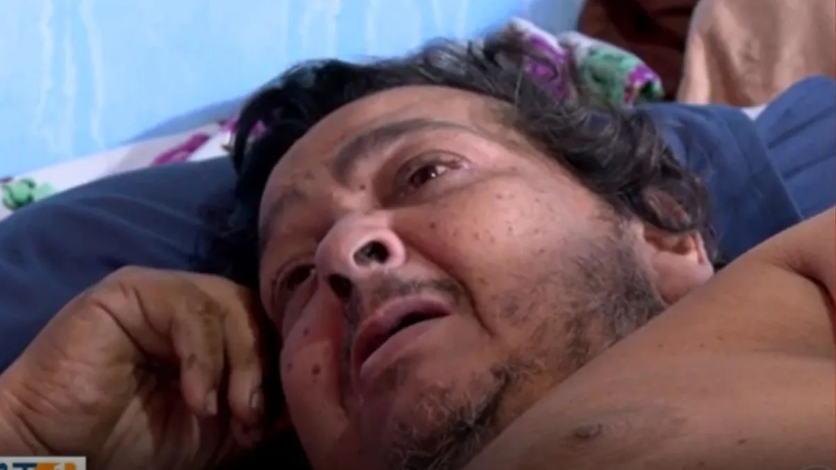 Mecânico de 230 kg morre após dois meses internado à espera de cirurgia bariátrica em MT