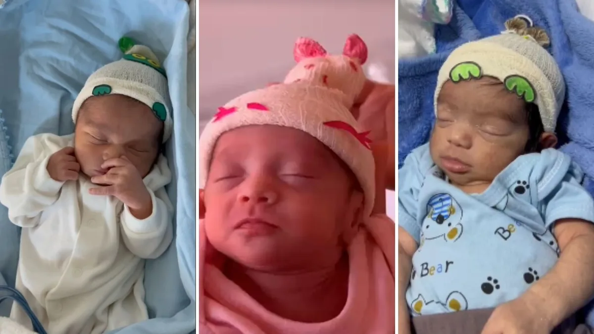 VÍDEO: bebês internados em Utin em hospital do ES participam de dia da 'touca maluca'