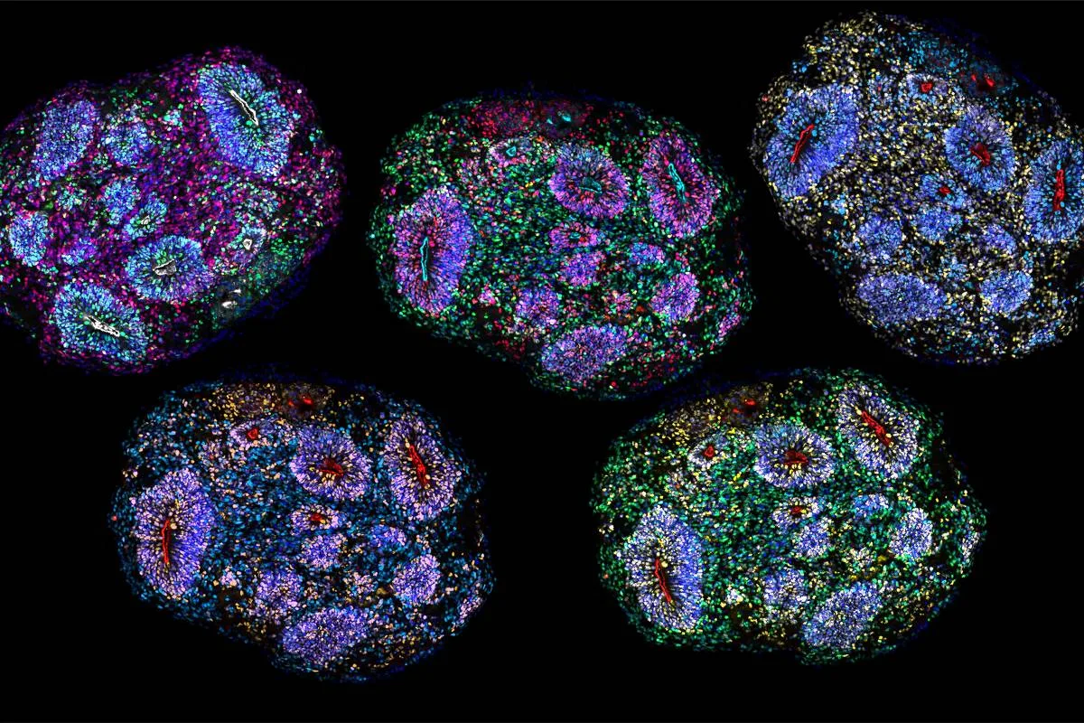 'Minicérebros' de laboratório sobrevivem por mais de cinco anos