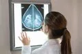 La OMS lanza un portal con IA para ayudar a los sanitarios a informar sobre el alcohol y el riesgo de cáncer de mama