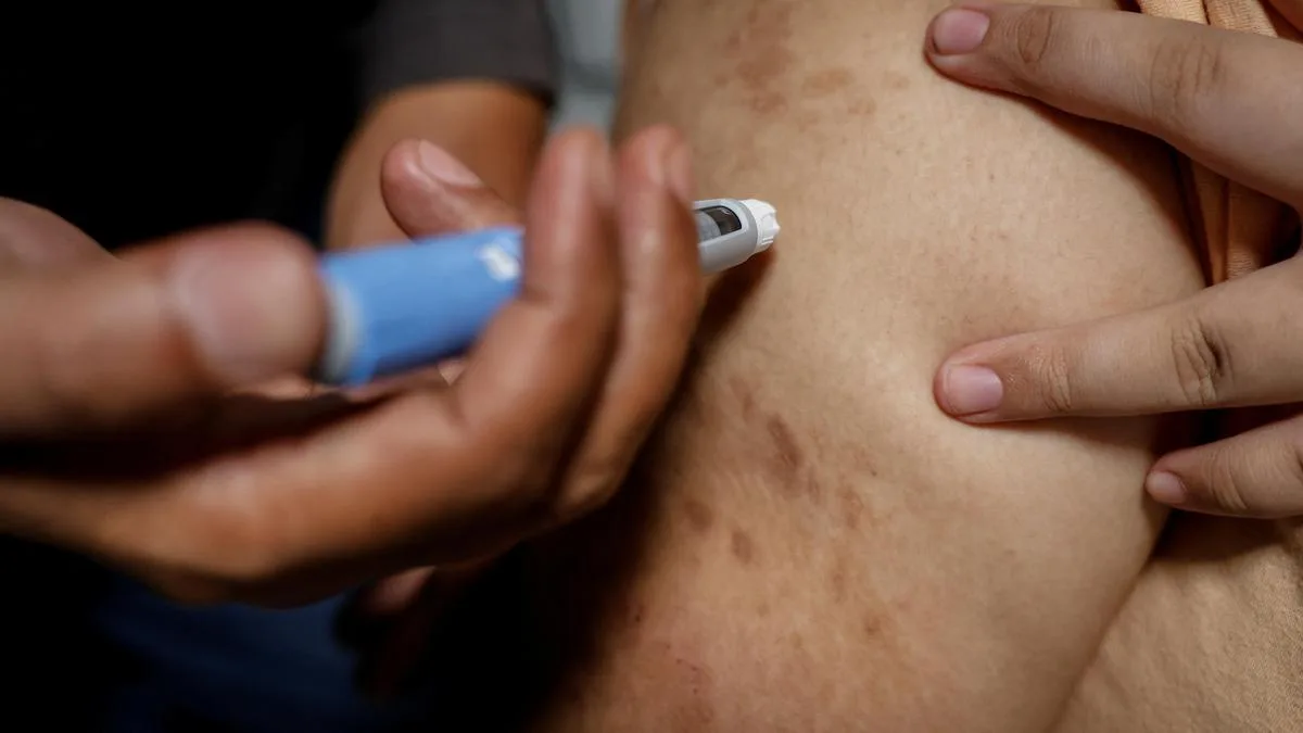 WHO says no obesity drugs, surgery for under-10s