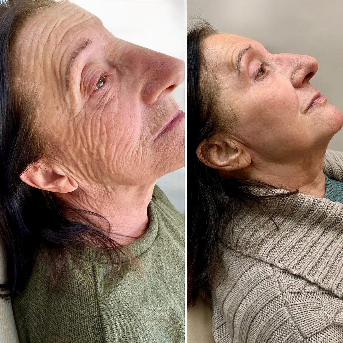 Empresa liderada por brasileiros em Portugal é finalista de prêmio mundial de medicina estética