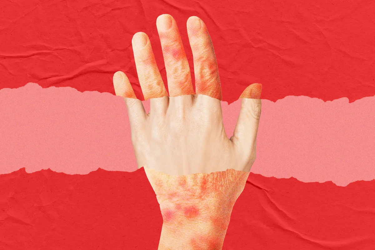 A New Anti-Aging Drug Looks to Turn Back the Clock on Skin Age
