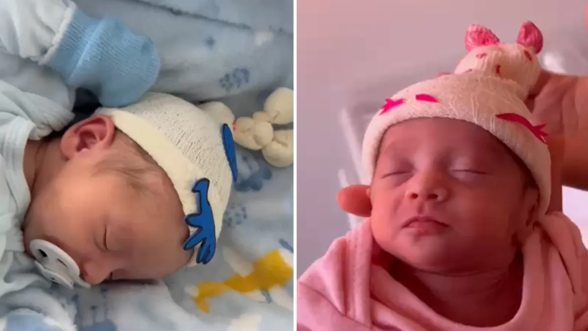Bebês de UTI neonatal ganham 'toucas malucas' em ação de Dia das Crianças