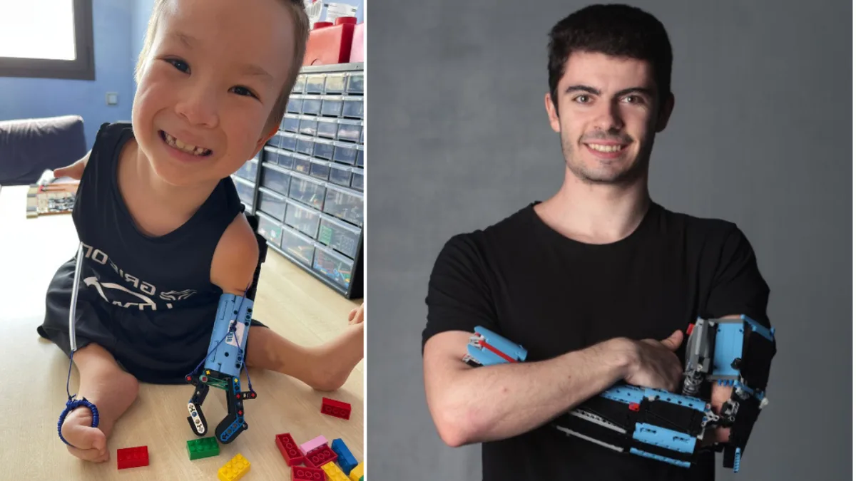 Born with an underdeveloped arm, he built a LEGO prosthetic at 18 to help another boy