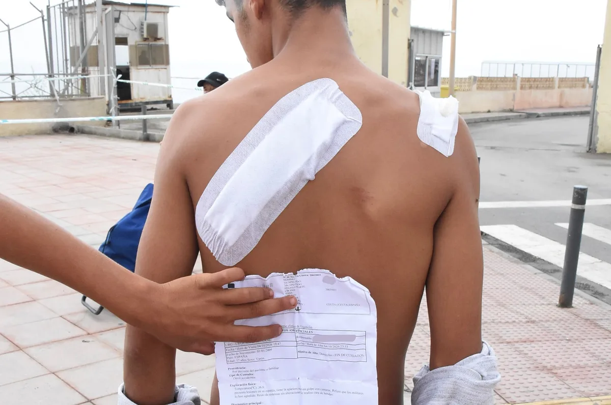 El hospital de Ceuta remite al juez una veintena de partes de lesiones de inmigrantes que dicen haber sido agredidos por militares