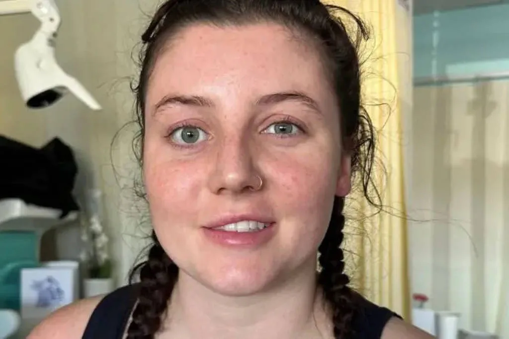 'O que aprendi ao ter um AVC aos 26 anos'