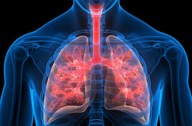 Câncer de pulmão: três medicamentos de alto custo entram para lista do SUS