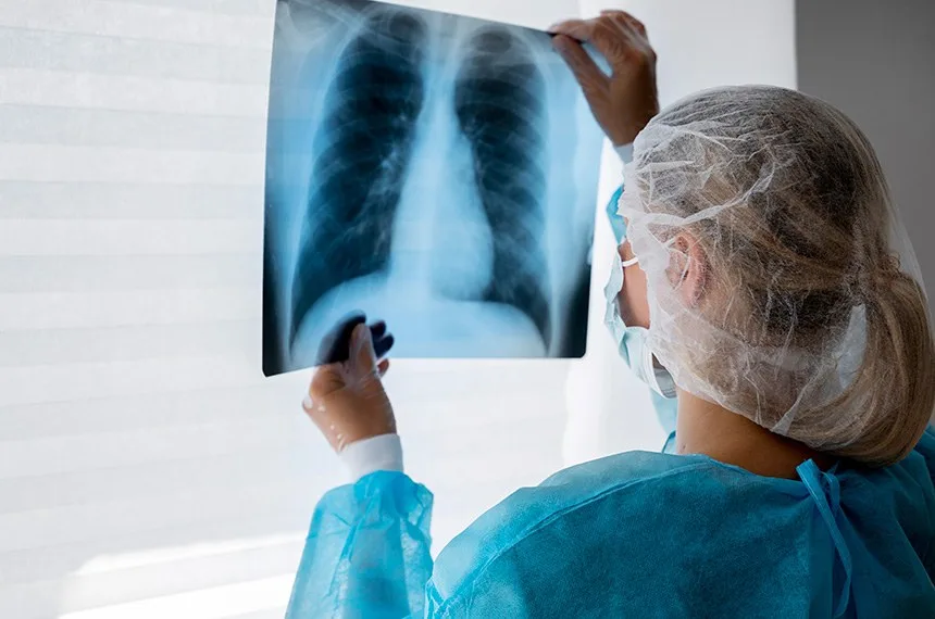 Câncer de pulmão pode ter até 95% de cura; conheça sinais de alerta