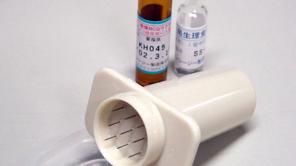 TB vaccine offers clue to retrain immune system against Alzheimer’s