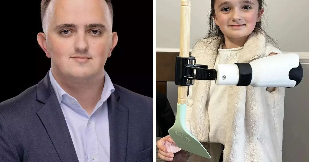 Aos 22 anos, estudante passou mais de 100 horas criando uma prótese multiferramenta para sua irmã de 7 anos em uma impressora 3D