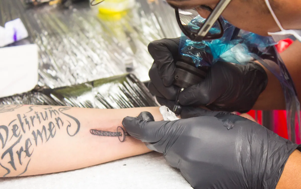 Tatuagem removida a laser: saiba para onde vai a tinta no corpo