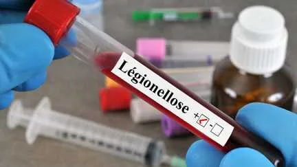 Légionellose en Savoie : trois personnes décédées et 46 cas recensés depuis le mois de juin, le bilan s'alourdit