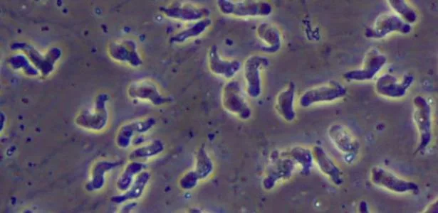 Ameba 'comedora de cérebro' mata adolescente nos EUA