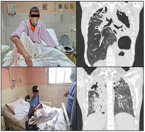 Mantienen vigilancia contra tuberculosis y enfermedades sexuales en el Cereso de Piedras Negras