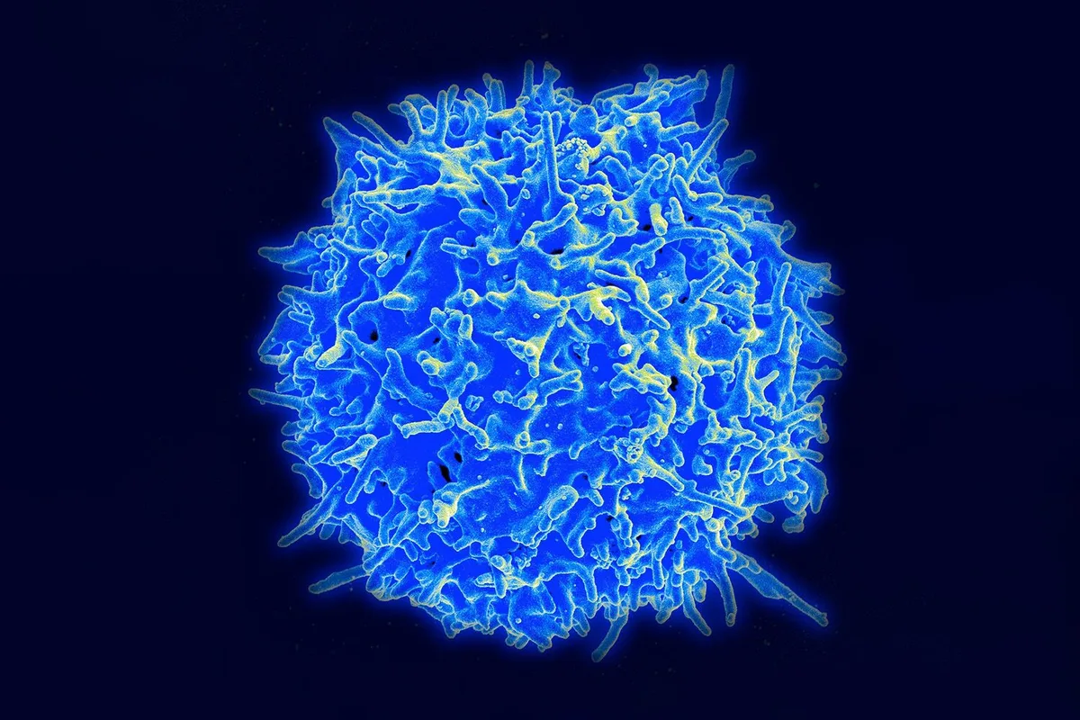 Duas doses de CAR-T fizeram regredir totalmente um cancro infantil