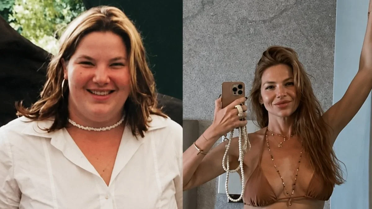 Repórter da Globo perde 75 kg após bariátrica e revela sequelas da cirurgia: “Perdi dentes”