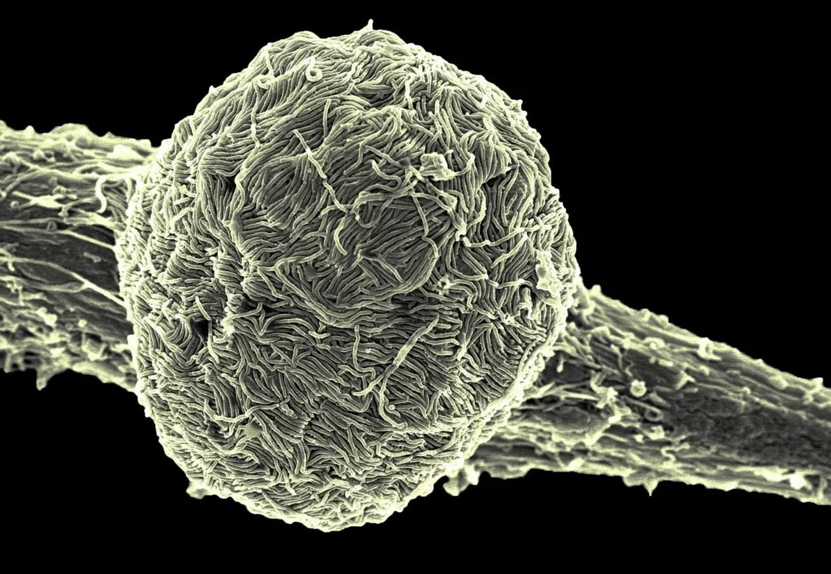 Uganda declara el final del brote de ébola tras 42 días sin contagios tras el alta del último paciente