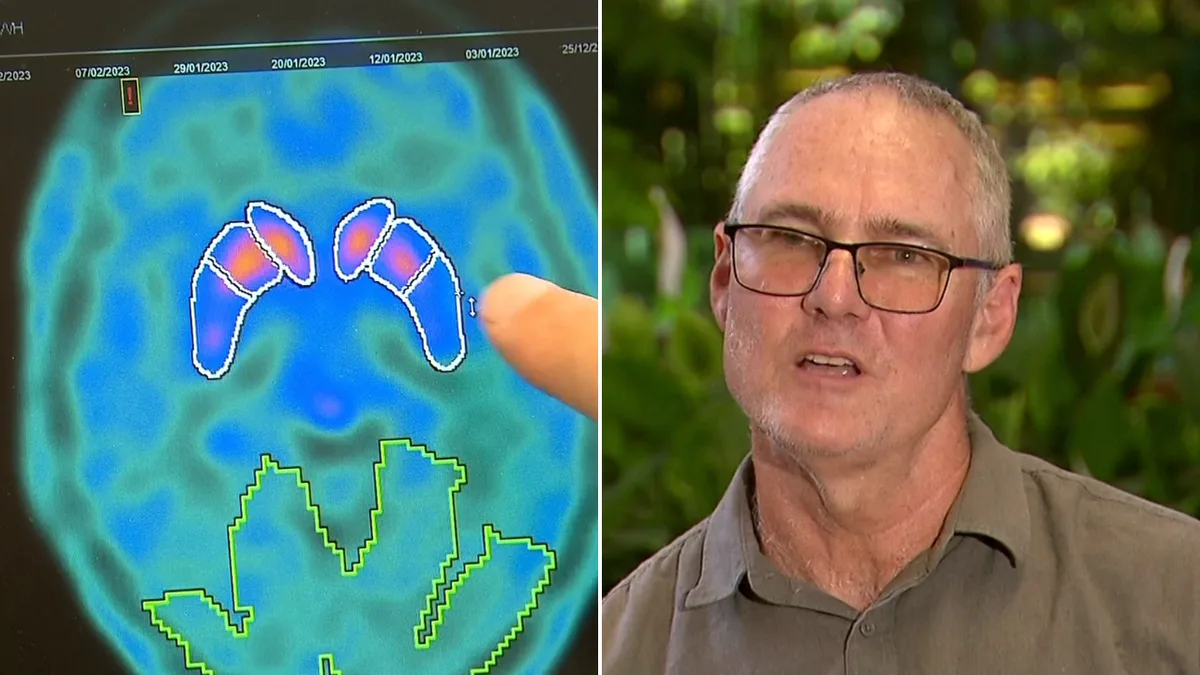 'It felt like a life sentence': New hope for Parkinson's sufferers in Australian-first trial