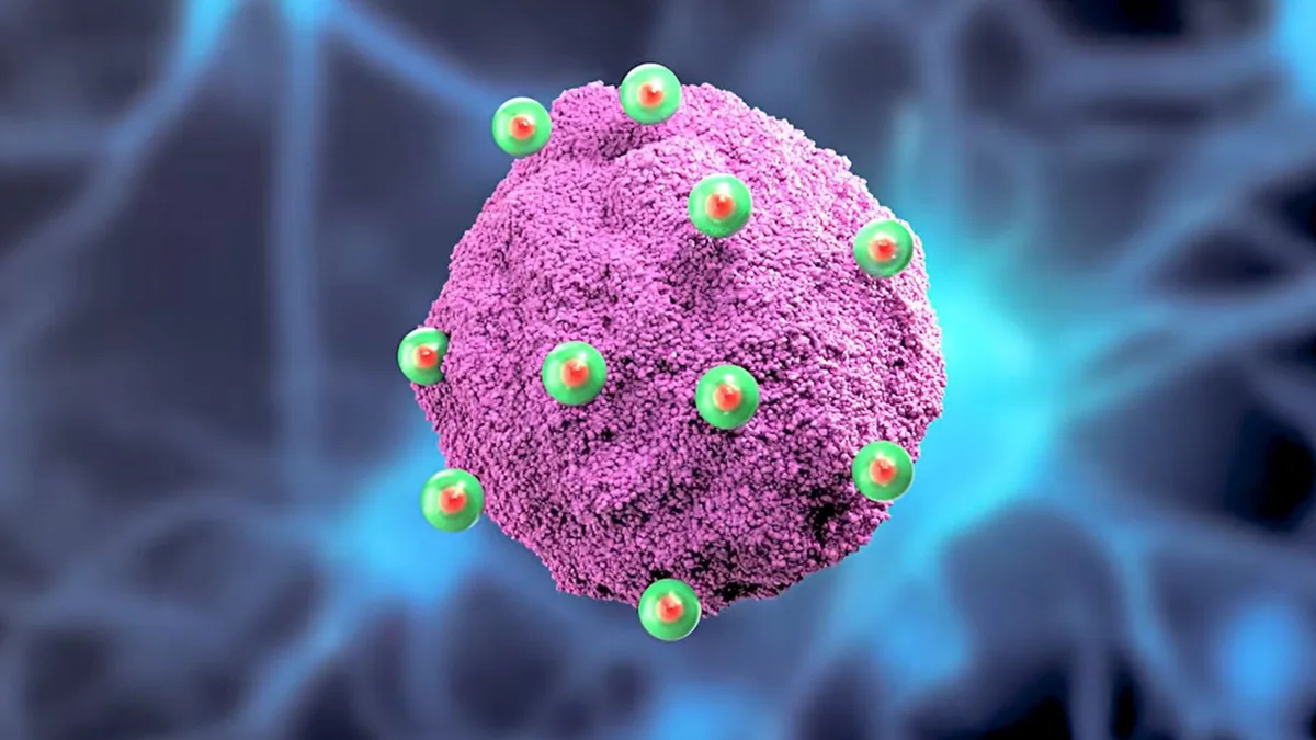 El MIT desarrolló nanoantenas inyectables que eliminan células cancerosas de glioblastoma sin efectos adversos