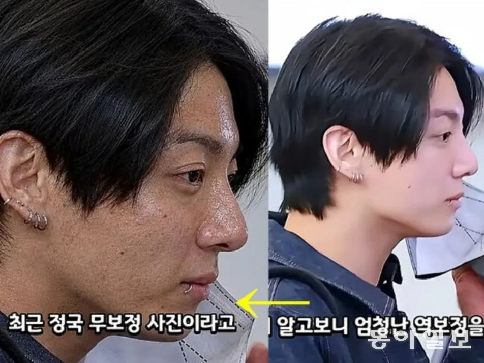 멀쩡한 정국 피부를 ‘귤껍질’로…악플러 ‘역보정’에 팬들 분노