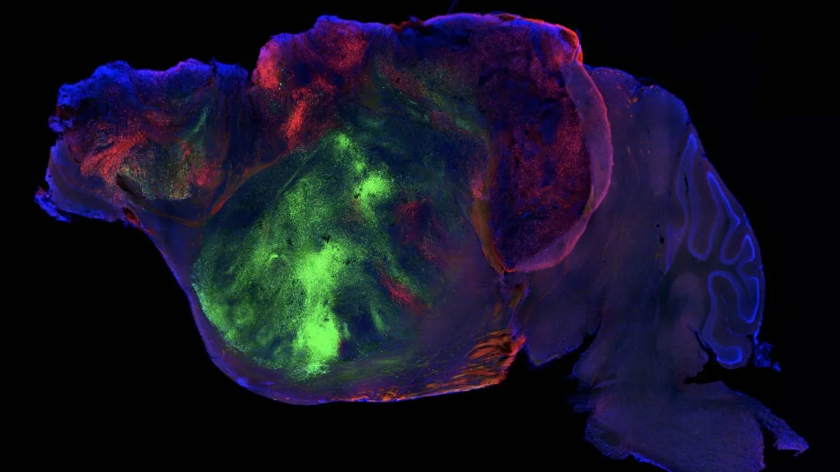 Trasplantan corteza cerebral humana a ratones y lo que sucede es algo que desafía a la biología