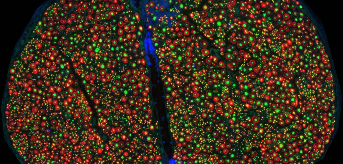 Wissenschaftler veröffentlichen weltweit erste anatomische Karte des Vagusnervs