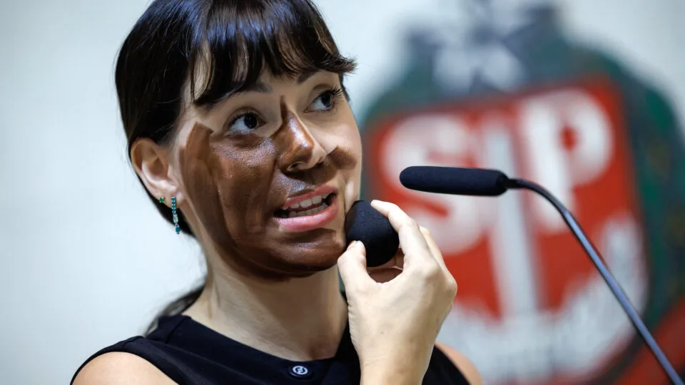 MP pede arquivamento de acusação de racismo contra Fabiana Bolsonaro por “blackface”