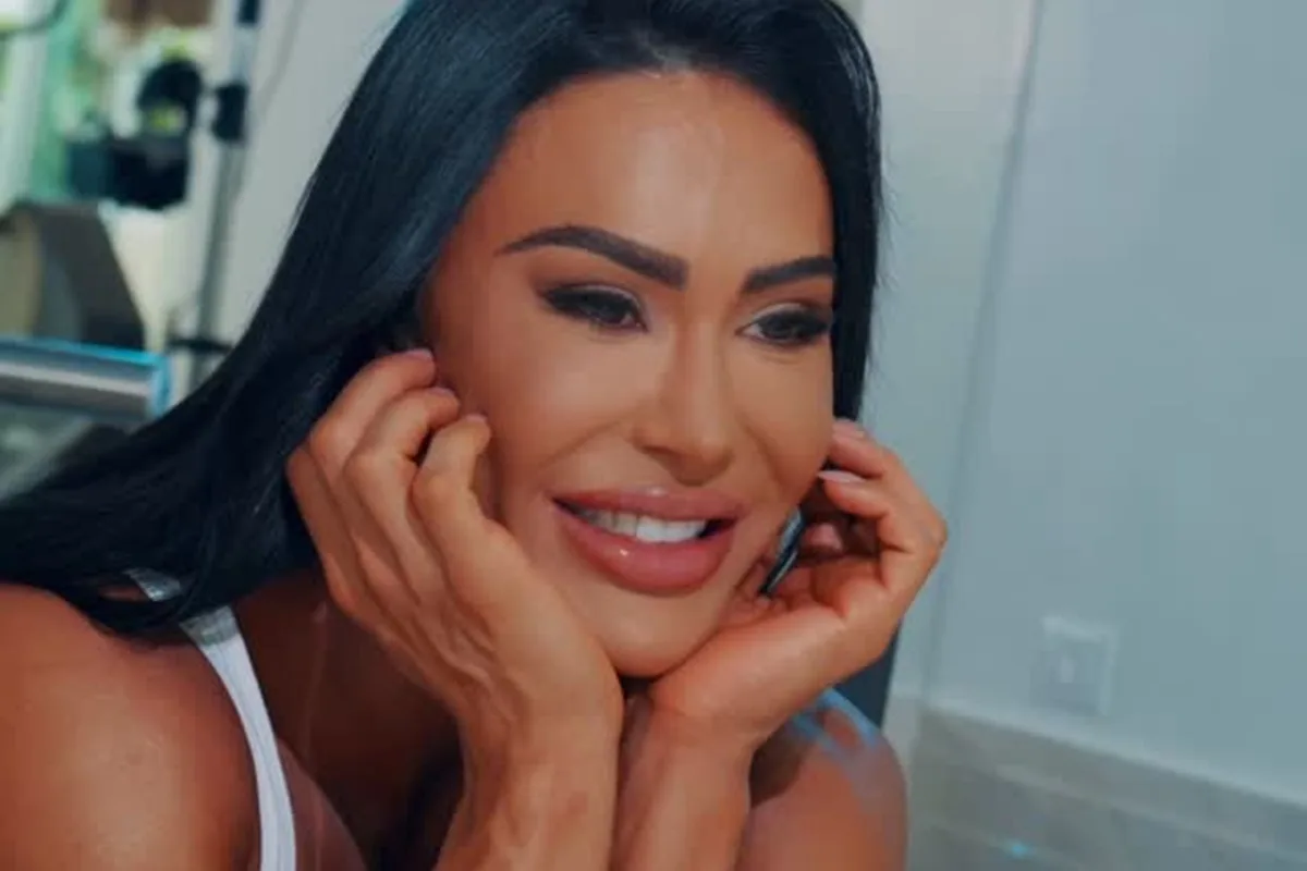 Gracyanne Barbosa: especialista explica inchaço após Dança dos Famosos