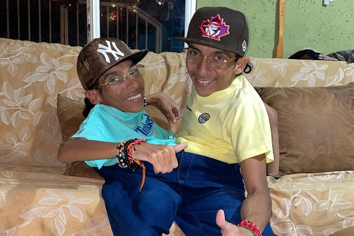 Gêmeos siameses do Equador morrem aos 27 anos na Colômbia