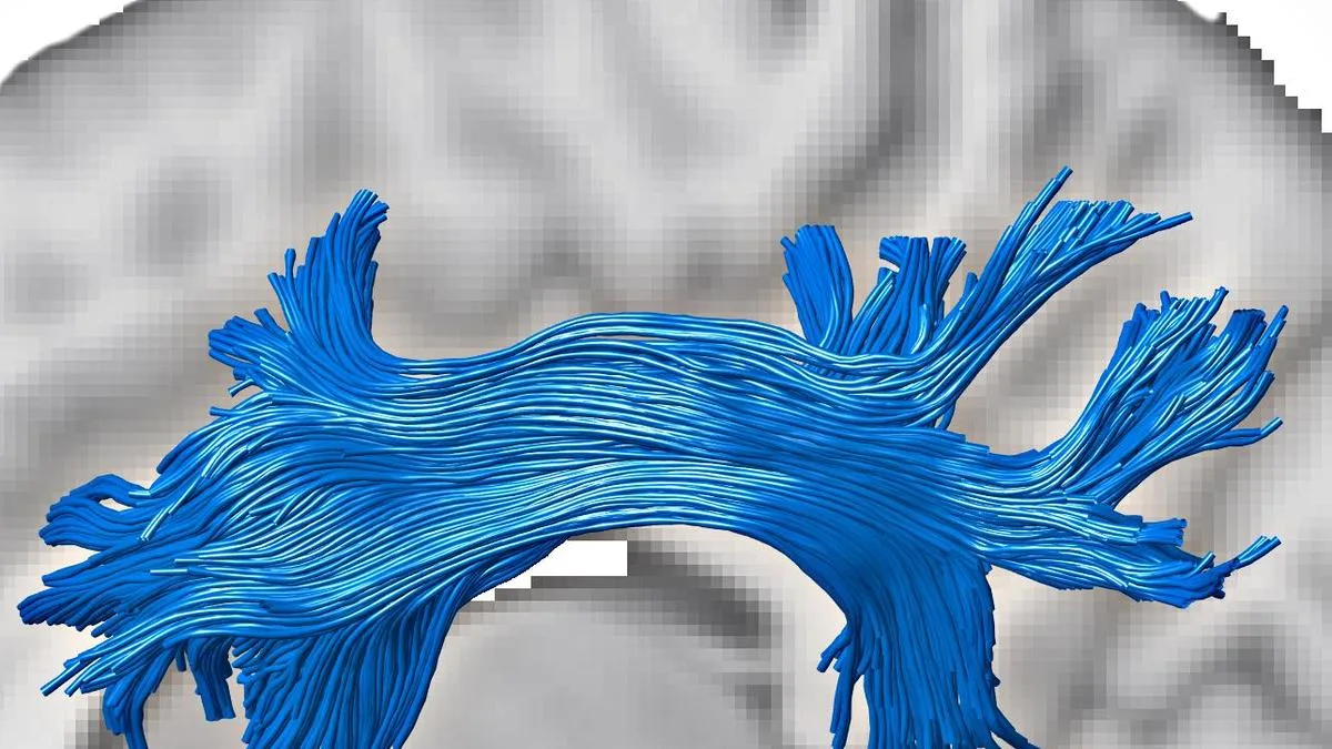 Brain's white matter may help soften cognitive impacts of gray matter loss: Study