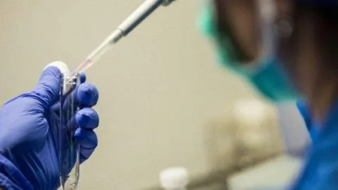 IVI investiga si una muestra de saliva puede ayudar a detectar el riesgo de ansiedad y estrés en tratamientos de fertilidad
