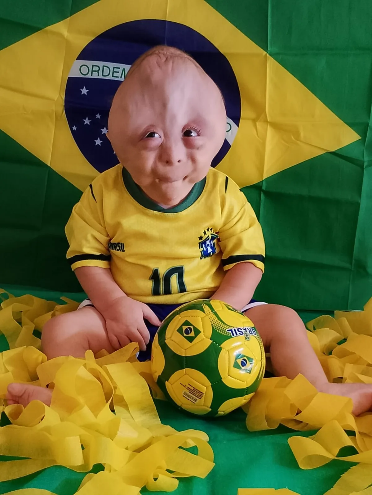 Família da Paraíba viraliza ao mostrar rotina e desafios de filho que nasceu com múltiplas malformações