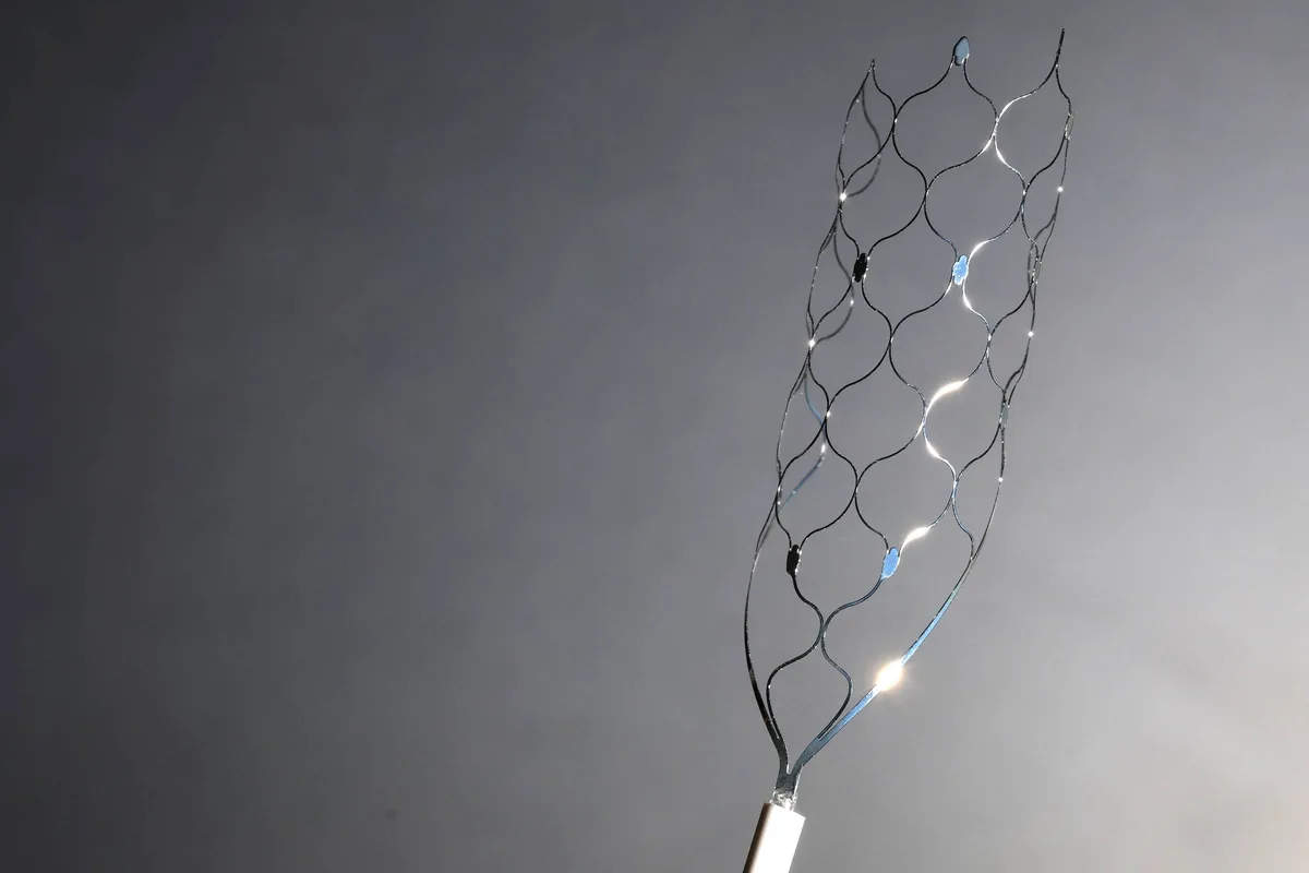 Nova técnica pode desobstruir artérias calcificadas sem uso de stent