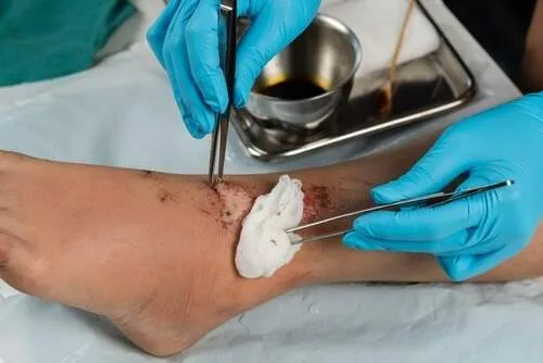 Farmacêuticos podem avaliar pé diabético e fazer curativos simples