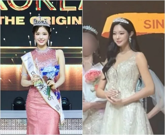 '작년 미코 진' 정연우, 우서윤 성형논란 속 시술 고백 "자연미인이면 가치 오르나" [전문]