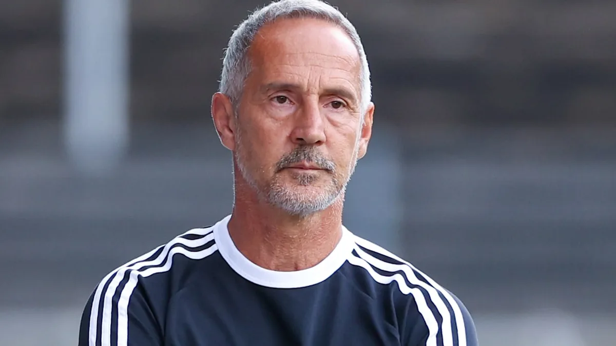 Auch das noch! - Große Start-Sorgen um wichtigen Eintracht-Star