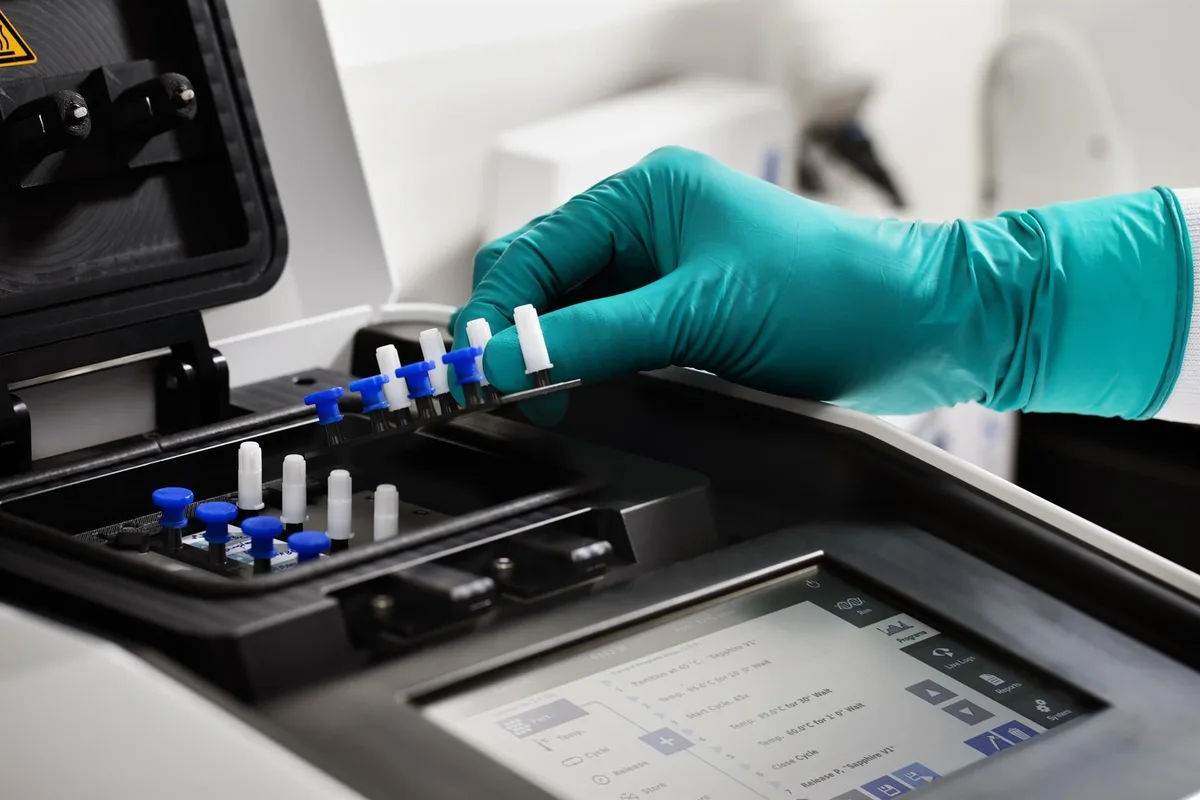 La UE destina 2,1 millones de euros a test PCR para la OMS contra el brote de ébola en RDC