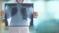 Una nueva prueba podría acelerar drásticamente el diagnóstico de infecciones pulmonares difíciles de detectar