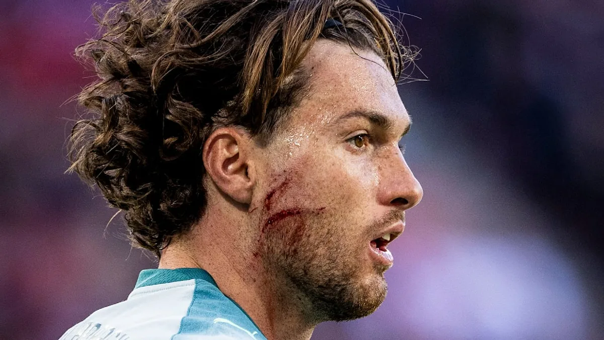 Oha! - Blutiger Kopf-Tritt gegen Gladbach-Star