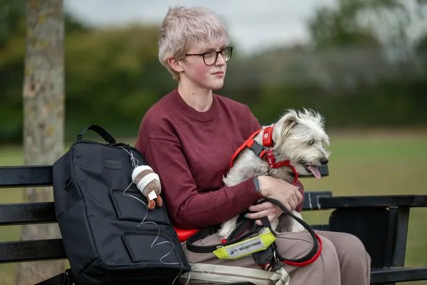 Woman, 29, has rare condition and can only have tea and biscuits